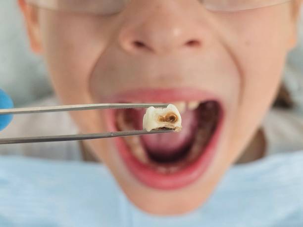 Best Emergency Dentist for Special Needs Patients in Laymantown, VA